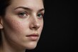 Woman with acne scars on skin against black background