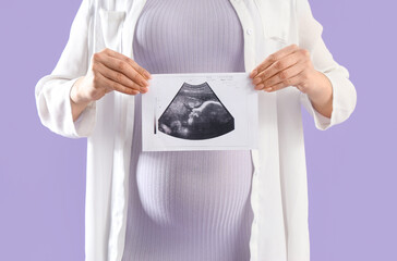 Poster - Young pregnant woman with sonogram image on lilac background