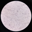 Hymenolepis nana (H.Nana) egg under 100X light microscope. Hymenolepiasis.