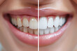 female open mouth with white teeth before and after the dental whitening procedure close-up