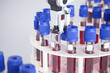 Advanced Automated Blood Analysis System Operating in Modern Laboratory