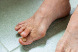 Fototapeta Kosmos - Asian woman suffer from serous Hallux Valgus over the feet toe