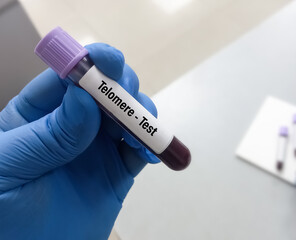 Poster - Test tube with blood sample for telomere test, anti-aging prognosis