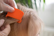 Close-up child's head with female hands searching for lice and nits in hair, combing through with orange comb for removal, Pediculosis