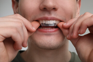 Canvas Print - Young man applying whitening strip on his teeth against light grey background, closeup