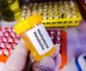 Poster - Urine sample for EDDP (Methadone Metabolite) test. metabolite of Methadone (substitution treatment against heroin addictions). Drug testing.