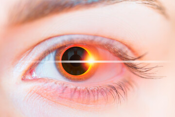 Poster - Solar eclipse in the girl eye 