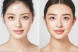 © Maki_Japan - 肌の綺麗な日本人モデルのビフォー・アフター美容広告風写真（美容整形・プチ整形・美肌）