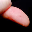 Wound on the finger of an adult man on a dark background
