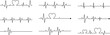 © Rabia - heart rhythm set , Electrocardiogram, ECG - EKG signal, Heart Beat pulse line concept design element isolated on transparent background, Concept of sport. Signs of rhythm, healthy life unhealthy ecg.