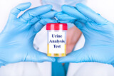 Fototapeta  - Laboratory sample of urine for drugs or substance test. Drug test is technical analysis of specimen to determine illegal drug abuse as cannabis, cocaine, methamphetamine, heroin and alcohol level.