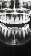 Dental x-ray black and white photo of healthy, clear human teeth. Close-up. Generative AI