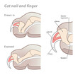 Domestic cat claw and finger anatomy vector illustration.  