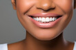 © Oksana - A close-up shot of the lower portion of a woman's Charming smile with white teeth for dental service promotions