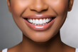 © Oksana - A close-up shot of the lower portion of a woman's Charming smile with white teeth for dental service promotions