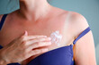 Woman with sunburned skin. Burn.