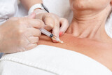 Fototapeta Przestrzenne - Dermatological rejuvenating skin injection  made by cosmetologist in a clinic.
