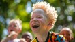 Child with albinism laughing heartily with friends in a park setting. Joyful outdoor child portrait with natural foliage background. Friendship and joy concept