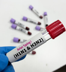 Wall Mural - Blood Sample for Avian typing I (H1N1 and H3N2) test, avian influenza virus (AIV), avian flu or bird flu.