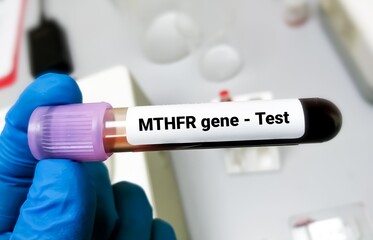 Sticker - Blood sample for MTHFR gene test. Methylenetetrahydrofolate reductase