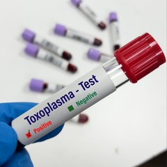 Sticker - Blood sample for Toxoplasma test at laboratory background.