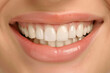 © Hunman - Close up of smile with white healthy teeth.