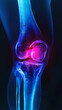 © AngrySun - Blue x-ray photograph of knee pain, pain glows red. Trauma concept. Medical checkup. Generative AI