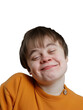 Closeup portrait of a kid with handicap, disabled teenager smiling, close-up on transparent background, youth with cute, happy expression, large smile, feeling good in spite of mental retardation