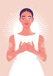 A young woman with vitiligo. Body positive. Self-love and acceptance. Body positive. Vector flat illustration