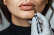 Cosmetic injection to plump lips close up with precision