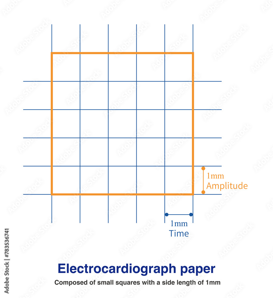 ECG paper is actually a coordinate paper used for recording, consisting ...