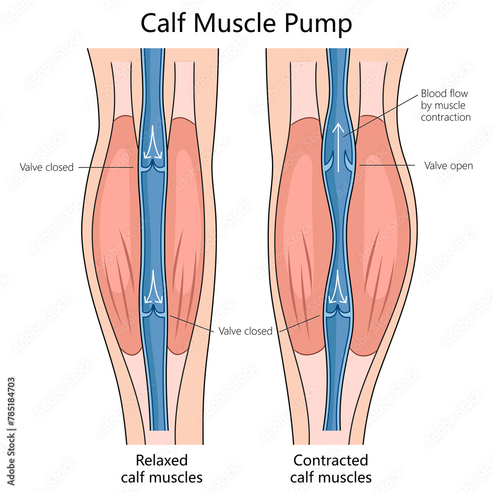 blood flow in relaxed and contracted calf muscles, indicating valve