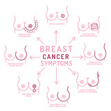 Fototapeta Pokój dzieciecy - Breast carcinoma, adenocarcinoma symptoms. Malignant breast growth signs.