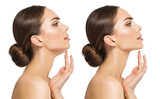 Fototapeta  - Double Chin Surgery Reduction. Women lower Jaw Before and After Plastic Surgery. Women Facelift Treatment and Exercise over White background