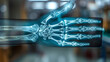 An x-ray of the patients wrist bone in a blue,
Clear Xray image illustrating a human hand joint and bone structure
