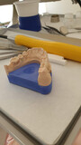 Fototapeta Dmuchawce - Kieferabdruck für Zahnprothese: Dentales 3D-Modell
