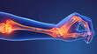 A color x-ray of the human hand, showing clearly the bones of the hand, which are inflamed from physical exertion.