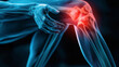 Knee painful, Knee injury, osteoarthritis, Arthritic knee joint anatomy illustration concept.