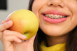 Close up of a smiling female teenager with braces mouth and an apple.