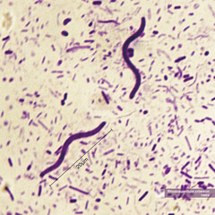 Crimson red spirochetes is a spiral shaped bacterium that is Gram negative and generally undergoes anaerobic phototrophic living.Magnify 1000x
