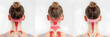 Detailed Step-by-Step Illustration of Correct Kinesiology (KT) Tape Application on Human Neck