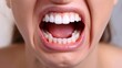 Close-up of clenched teeth and grimacing mouth showing dental pain, with a simple, uncluttered background.