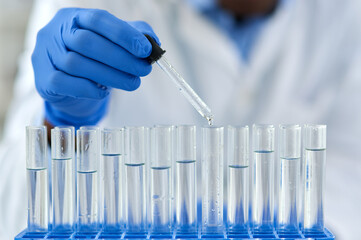 Poster - Hand, test tubes and pharmaceutical development for drugs, medicine and medical research. Person, laboratory and discovery for innovation, life extension and professional biochemistry scientist