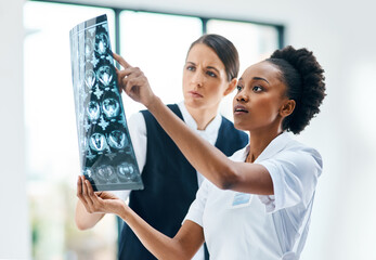 Canvas Print - Hospital, teamwork and women doctors with brain scan for review, diagnosis or consultation. Healthcare, neurology and medical MRI results with professional collaboration, advice and nurse at clinic