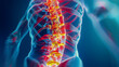 Human spine in x-ray on blue background. The neck spine is highlighted by yellow red colour. Medical examination of spinal injuries.
