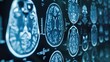 Human brain in a ct scan created with Generative AI