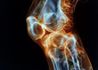 A detailed anatomical illustration of a knee and hand joint affected by osteoarthritis