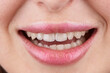 Macro photography of teeth with beautiful lips, showcasing veneers.
