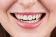 Macro photography of teeth with beautiful lips, showcasing veneers.