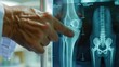 © Ibad - Orthopedic surgeon doctor examining patient's knee joint x-ray films, MRI bone, CT scan in at radiology orthopedic unit, hospital background. knee joint film x ray